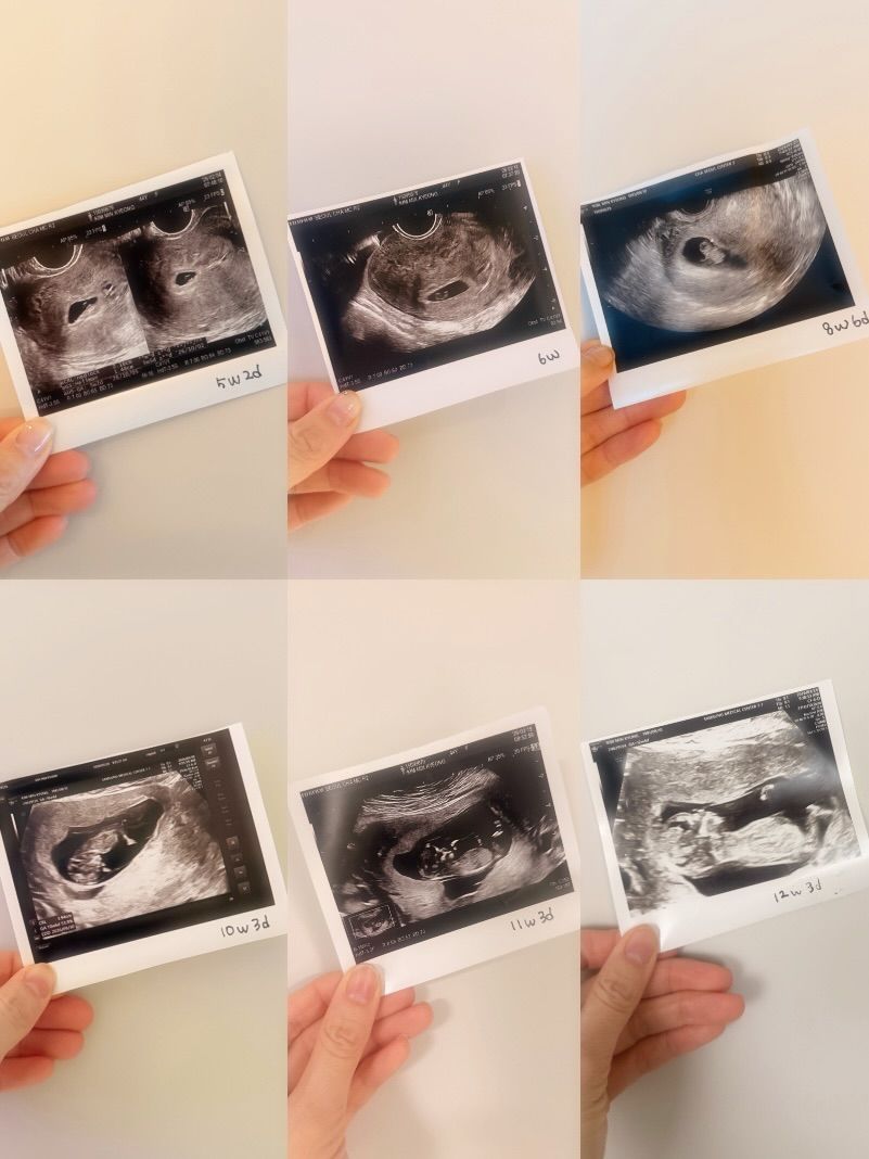 임신 소식 전한 김민경 